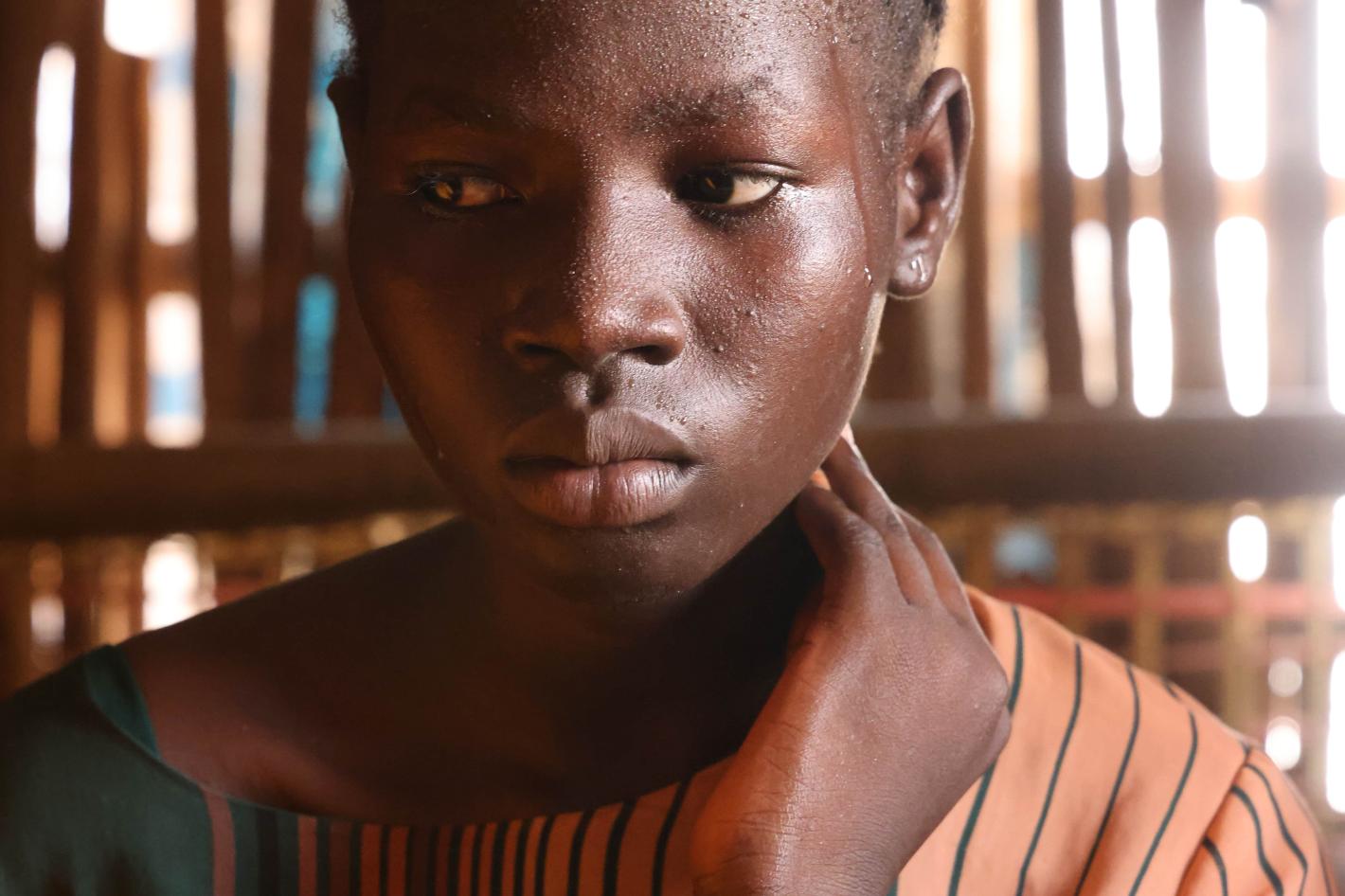 Girl in Mangatheen IDP camp